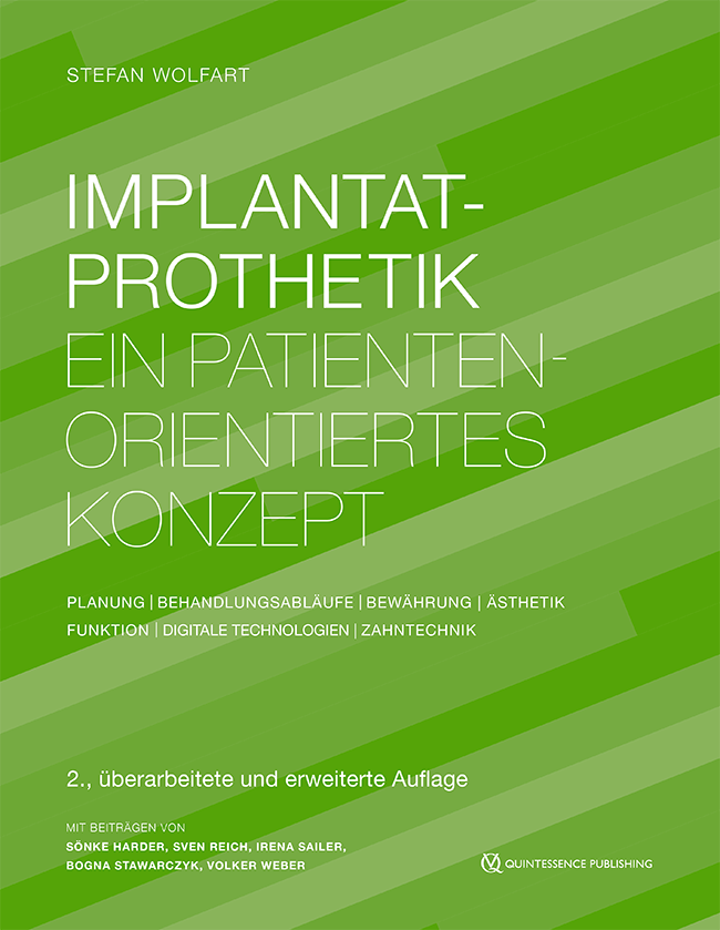 Wolfart: Implantatprothetik