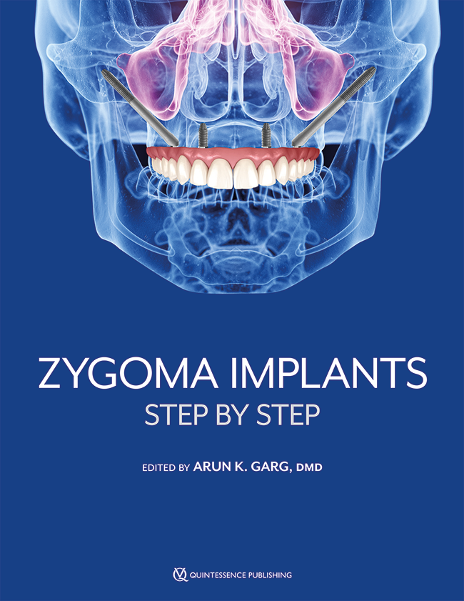 Garg: Zygoma Implants