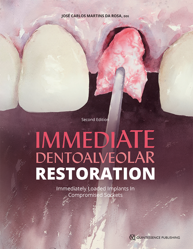 Martins da Rosa: Immediate Dentoalveolar Restoration