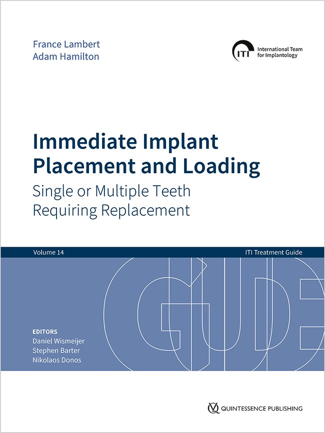 Wismeijer: Immediate Implant Placement and Loading – Single or Multiple Teeth Requiring Replacement