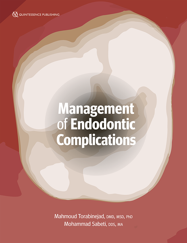 Torabinejad: Management of Endodontic Complications