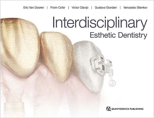 Van Dooren: Interdisciplinary Esthetic Dentistry