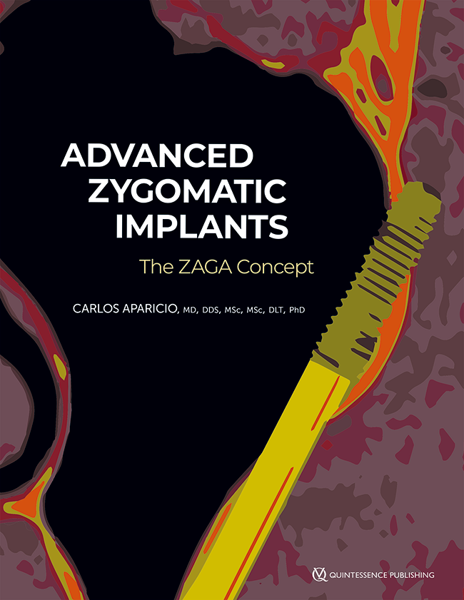 Aparicio: Advanced Zygomatic Implants