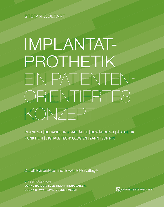 Wolfart: Implantatprothetik