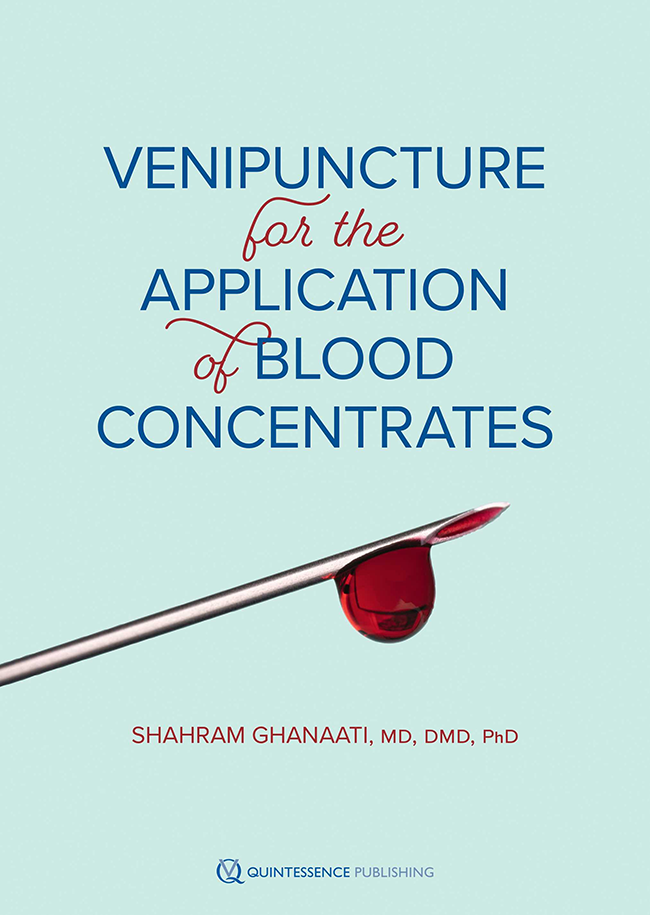 Ghanaati: Venipuncture for the Application of Blood Concentrates