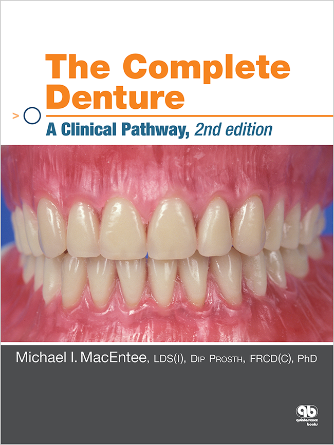 MacEntee: The Complete Denture