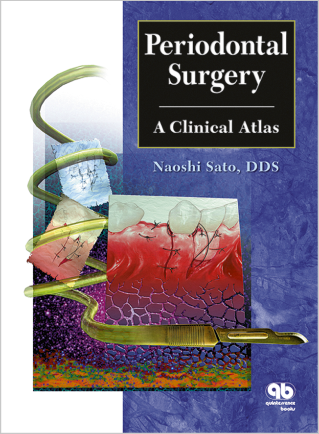 Sato: Periodontal Surgery