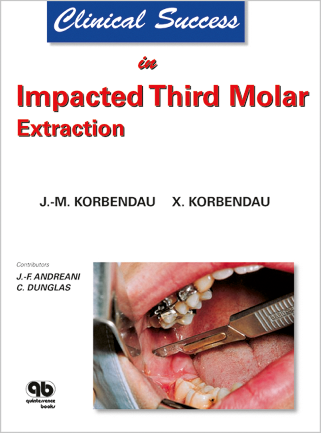 Korbendau: Clinical Success in Impacted Third Molar Extraction
