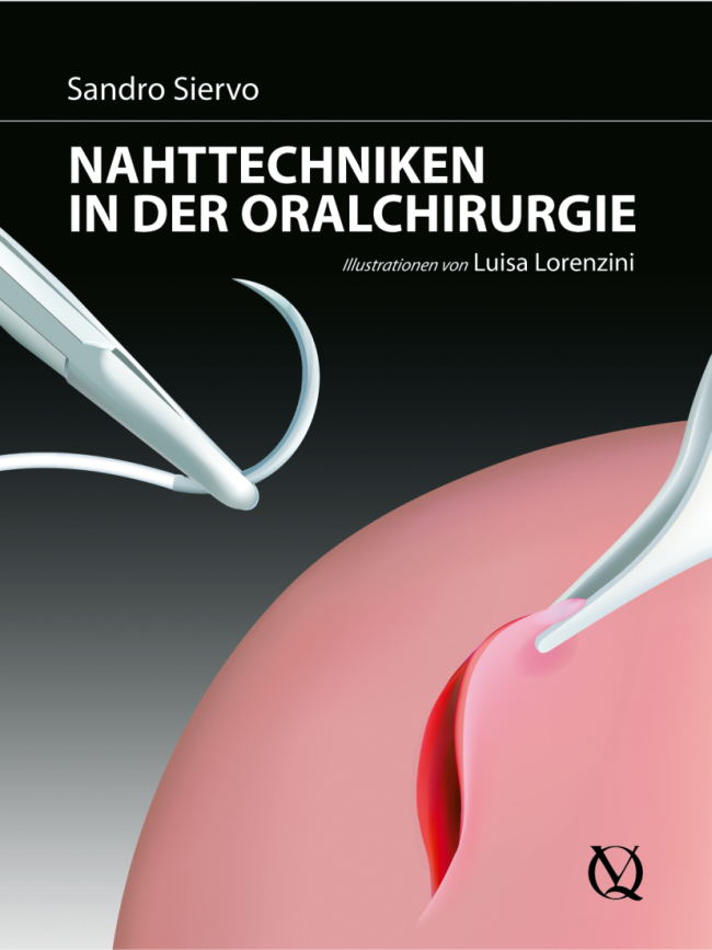 Siervo: Nahttechniken in der Oralchirurgie