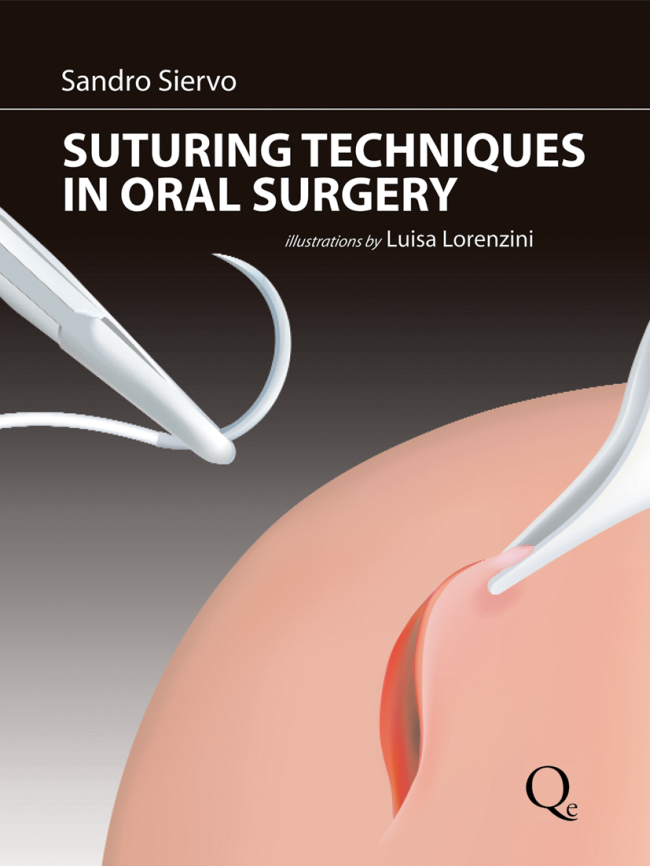 Siervo: Suturing Techniques in Oral Surgery