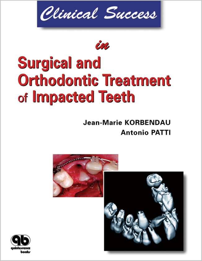 Korbendau: Clinical Success in Surgical and Orthodontic Treatment of Impacted Teeth