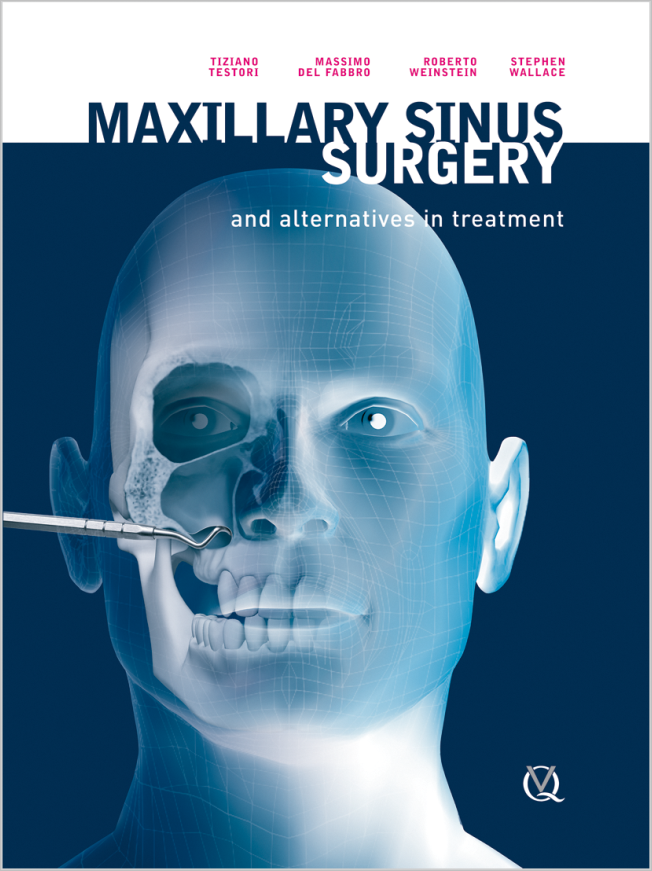 Testori: Maxillary Sinus Surgery and Alternatives in Treatment