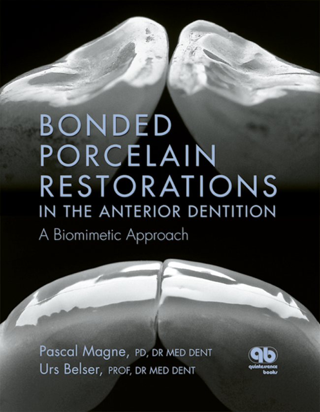 Magne: Bonded Porcelain Restorations in the Anterior Dentition