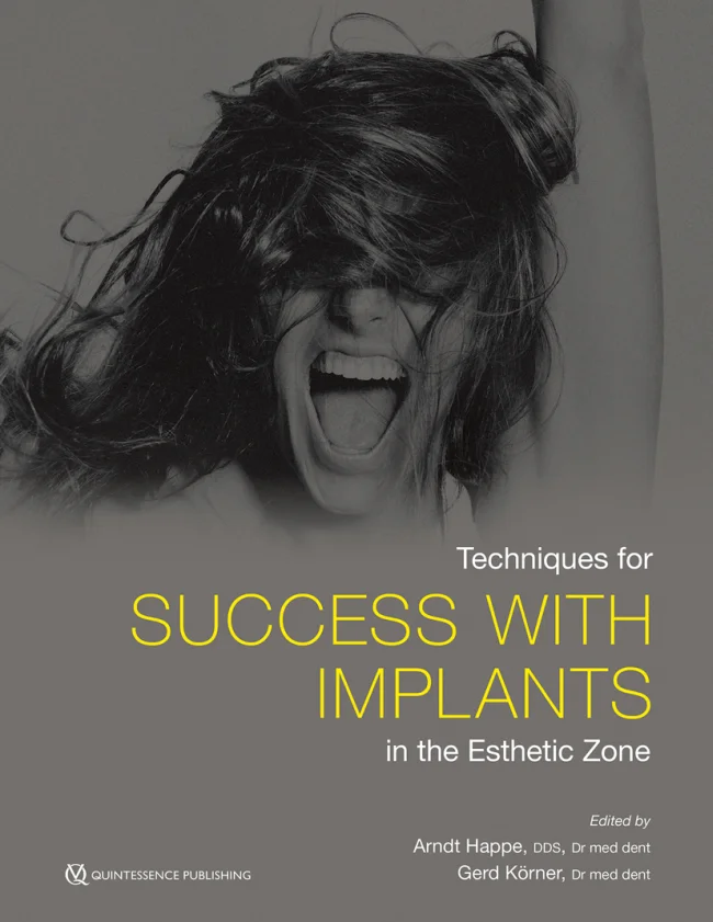 Happe: Techniques for Success with Implants in the Esthetic Zone