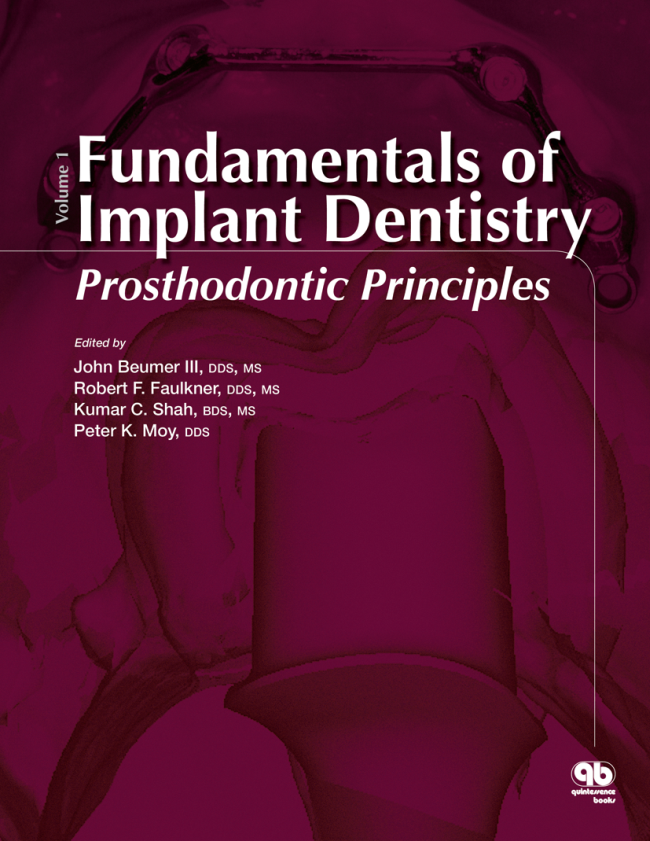 Beumer III: Fundamentals of Implant Dentistry 