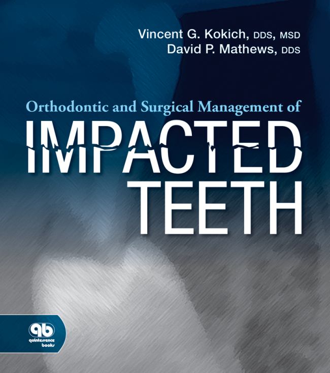 Kokich: Orthodontic and Surgical Management of Impacted Teeth