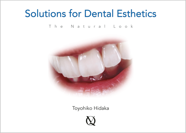 Hidaka: Solutions for Dental Esthetics
