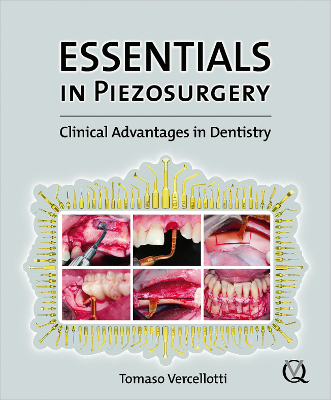 Vercellotti: Essentials in Piezosurgery