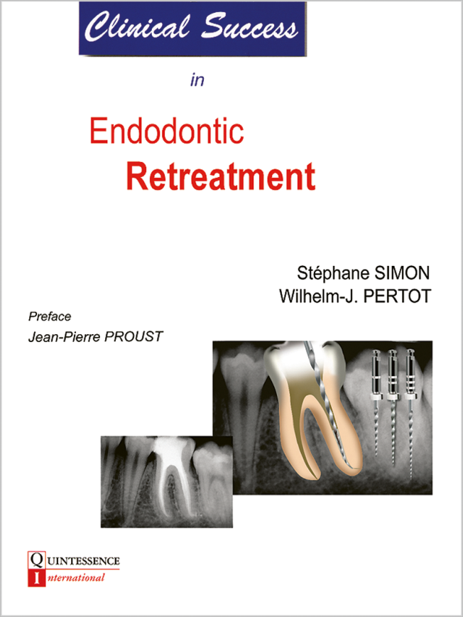 Simon: Clinical Success in Endodontic Retreatment