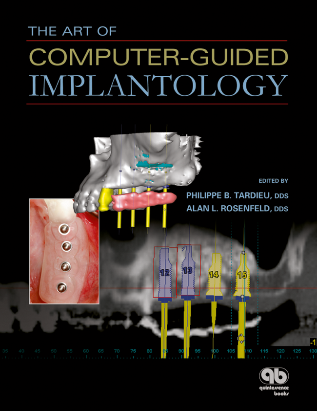 Tardieu: The Art of Computer-Guided Implantology