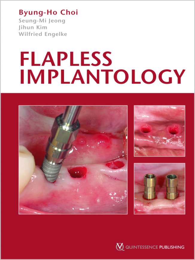 Choi: Flapless Implantology