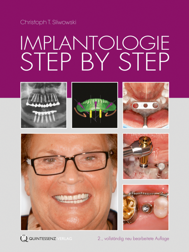 Sliwowski: Implantologie Step by Step