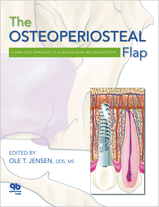 Jensen: The Osteoperiosteal Flap