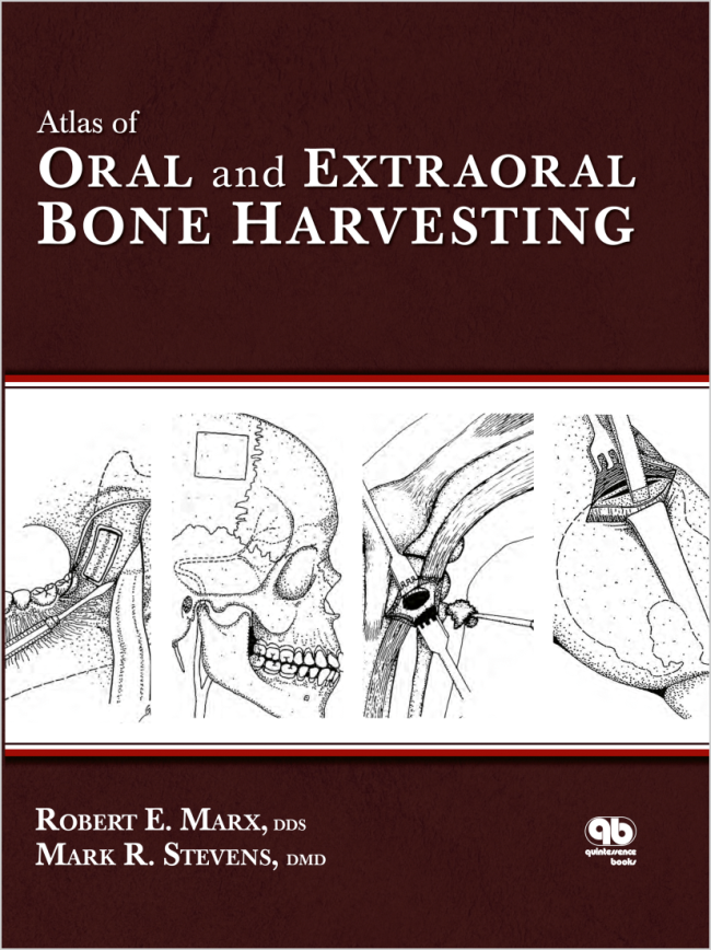 Marx: Atlas of Oral and Extraoral Bone Harvesting