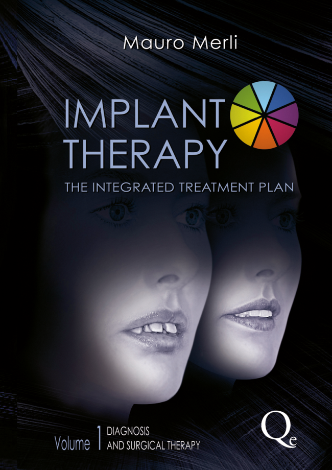 Merli: Implant Therapy