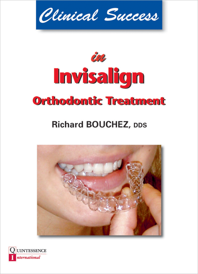 Bouchez: Clinical Success in Invisalign Orthodontic Treatment