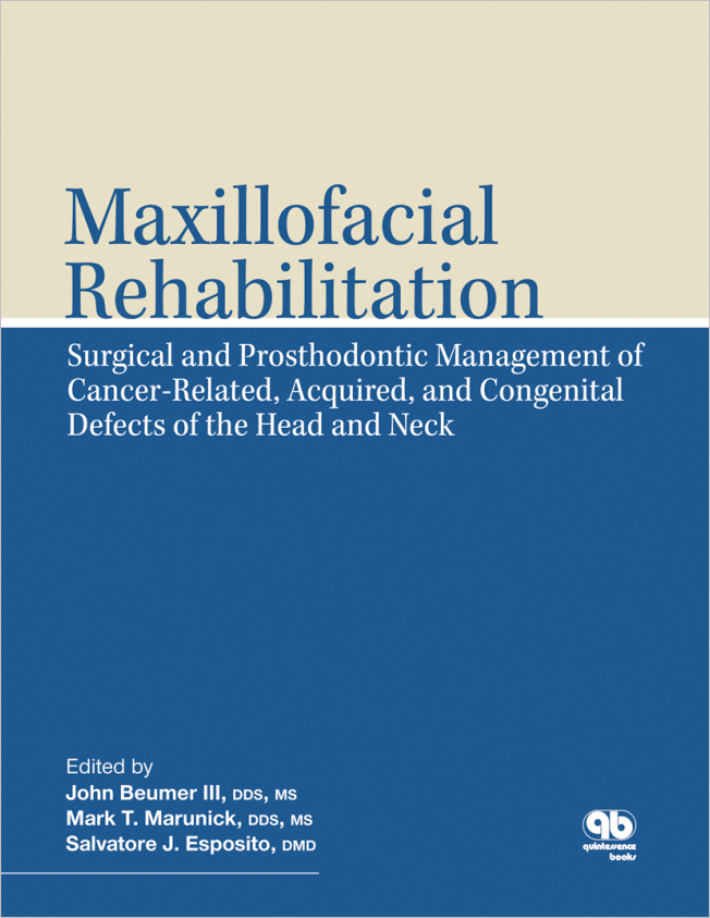 Beumer III: Maxillofacial Rehabilitation