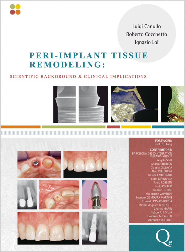 Canullo: Peri-Implant Tissue Remodeling