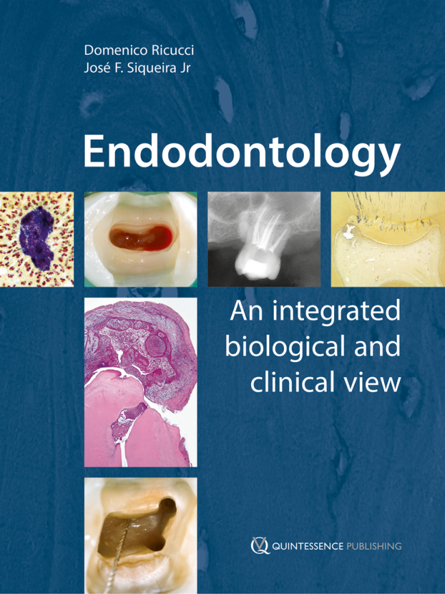 Ricucci: Endodontology
