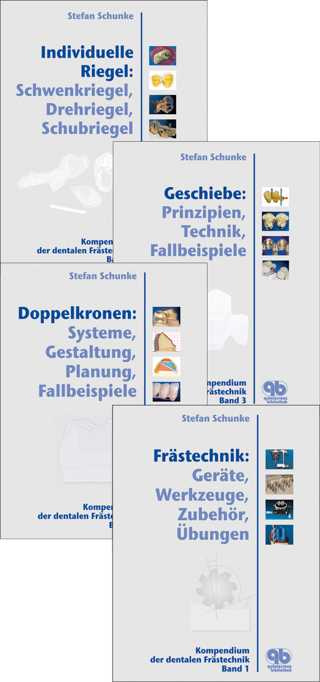 Schunke: Kompendium der dentalen Frästechnik