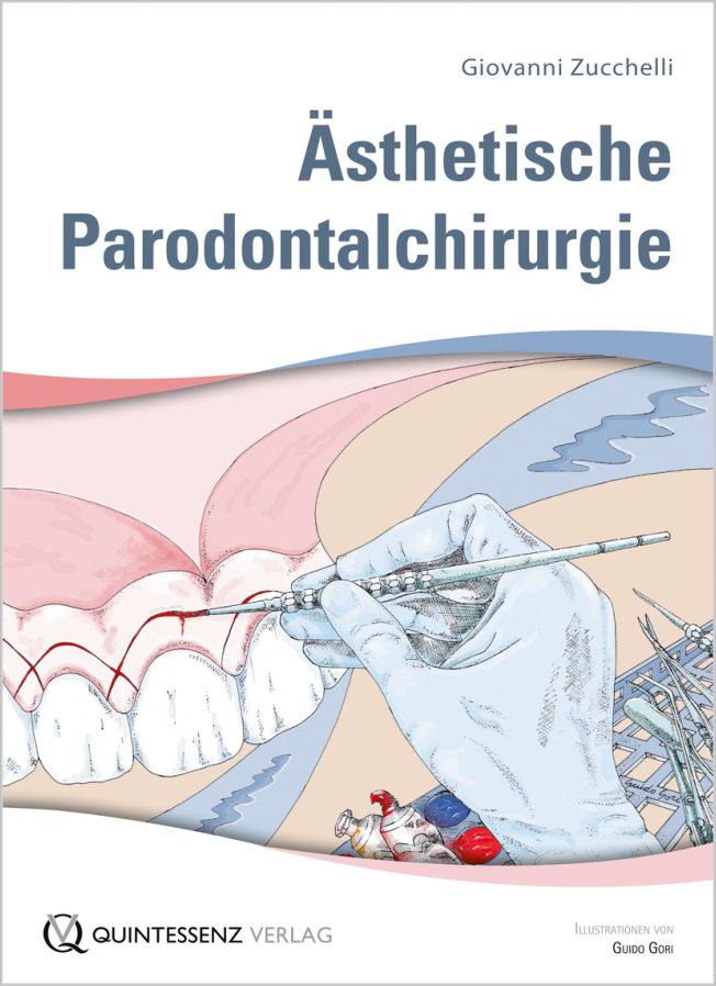 Zucchelli: Ästhetische Parodontalchirurgie