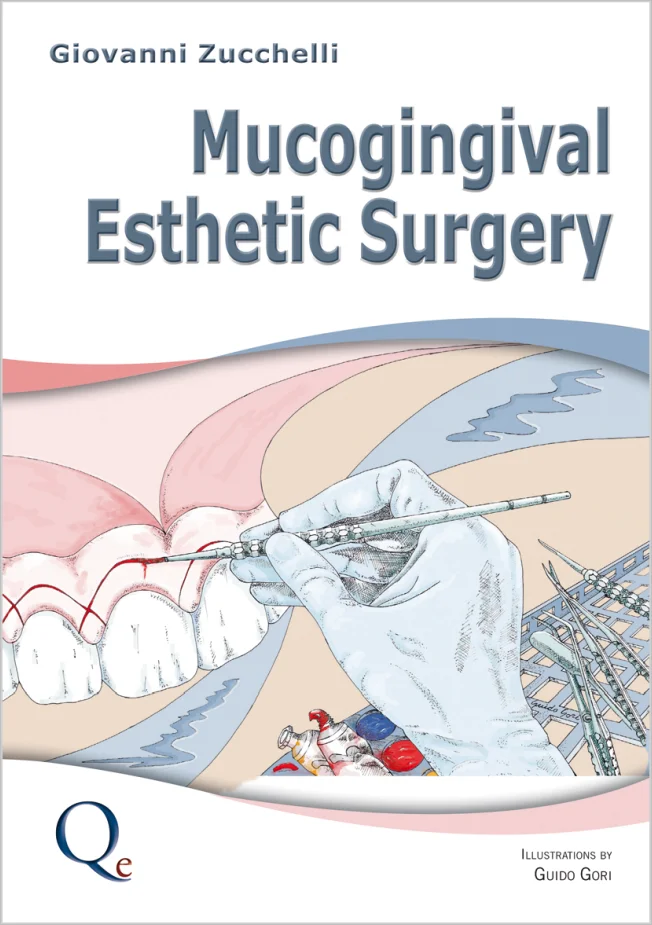 Zucchelli: Mucogingival Esthetic Surgery