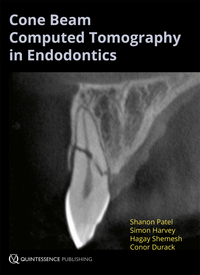 Patel: Cone Beam Computed Tomography in Endodontics