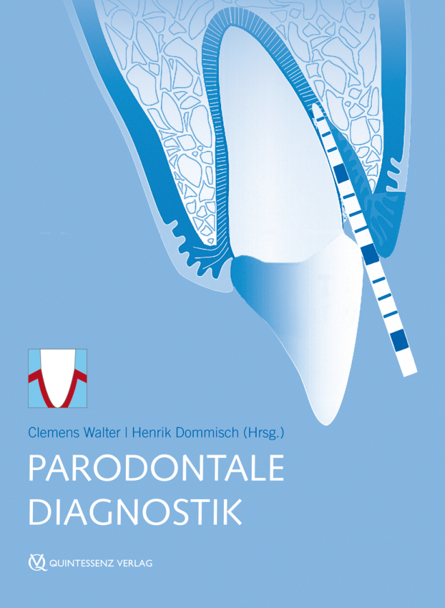 Walter: Parodontale Diagnostik