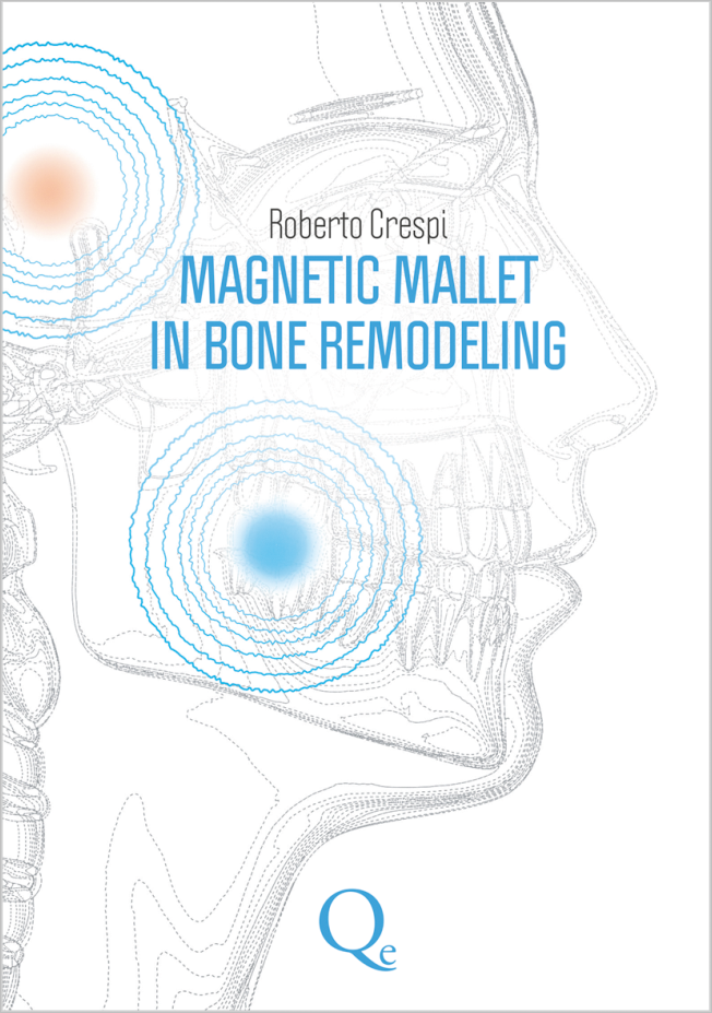 Crespi: Magnetic Mallet in Bone Remodeling