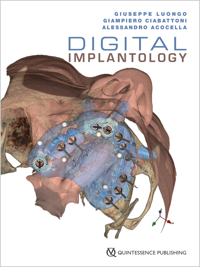 Luongo: Digital Implantology
