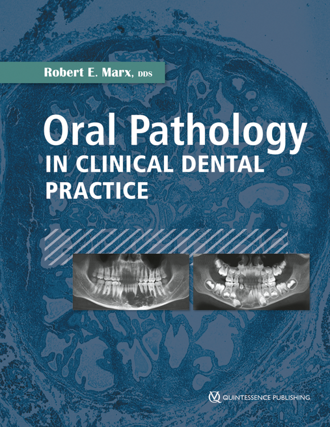 Marx: Oral Pathology in Clinical Dental Practice