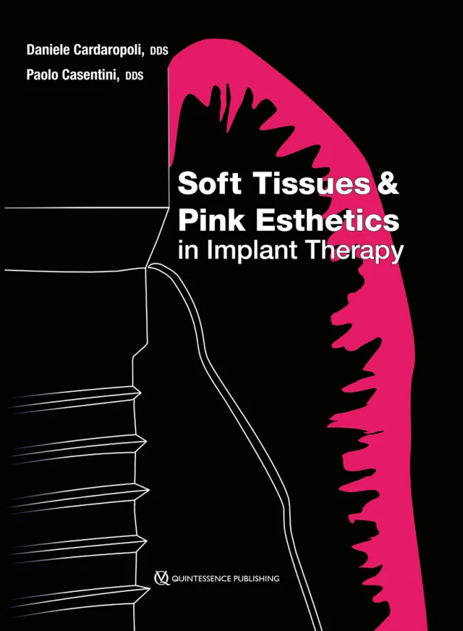 Cardaropoli: Soft Tissues and Pink Esthetics in Implant Therapy