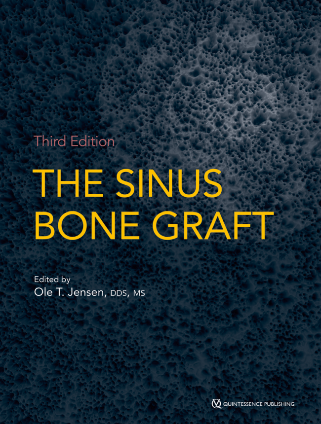 Jensen: The Sinus Bone Graft