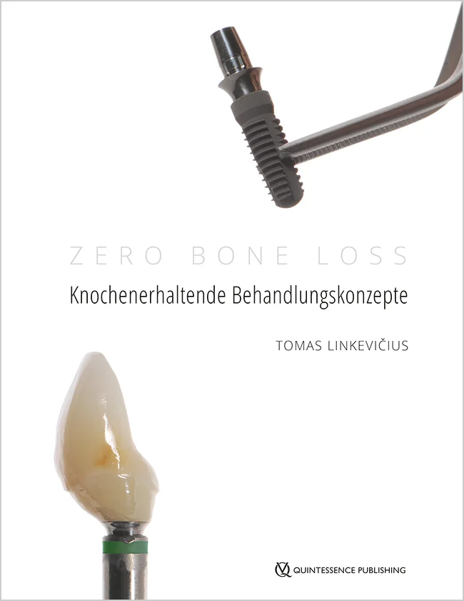 Linkevičius: Zero Bone Loss: Knochenerhaltende Behandlungskonzepte