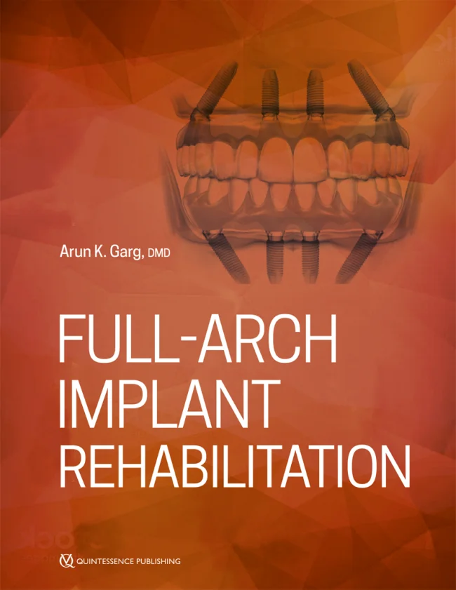 Garg: Full-Arch Implant Rehabilitation