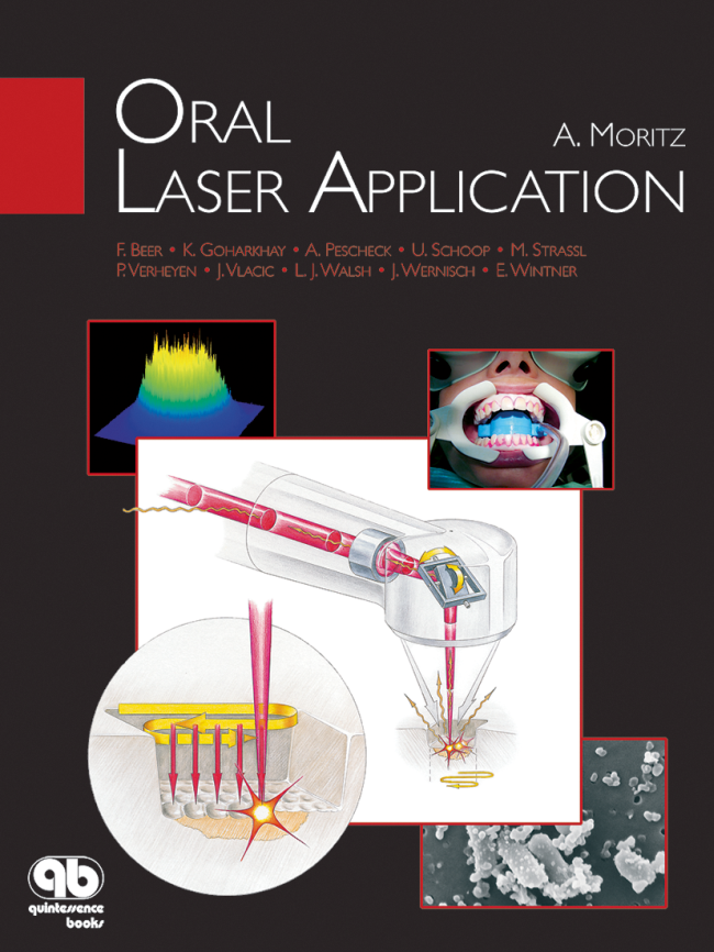 Moritz: Oral Laser Application