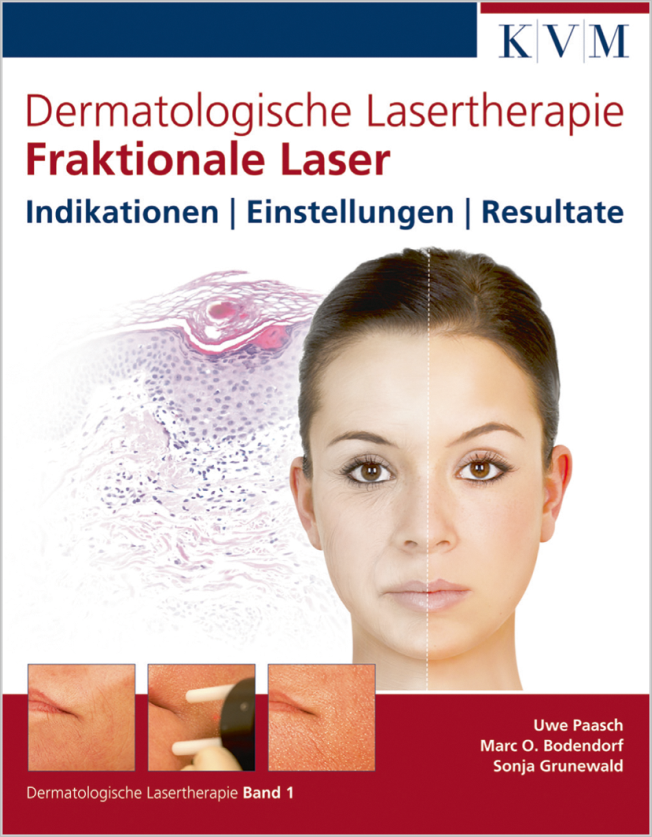 Paasch: Dermatologische Lasertherapie