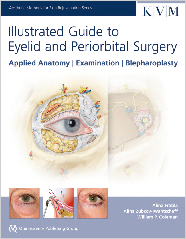 Fratila: Illustrated Guide to Eyelid and Periorbital Surgery