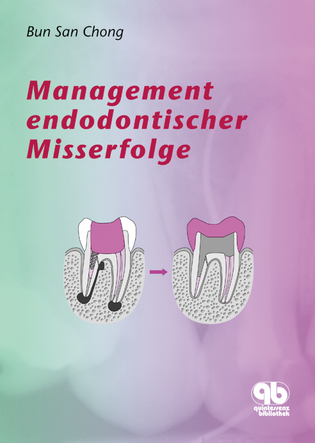 Chong: Management endodontischer Misserfolge