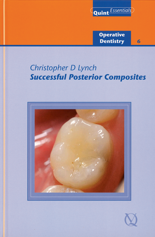Lynch: Successful Posterior Composites